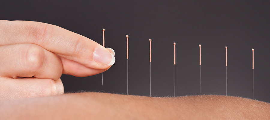 akupunktura legnica-lubin