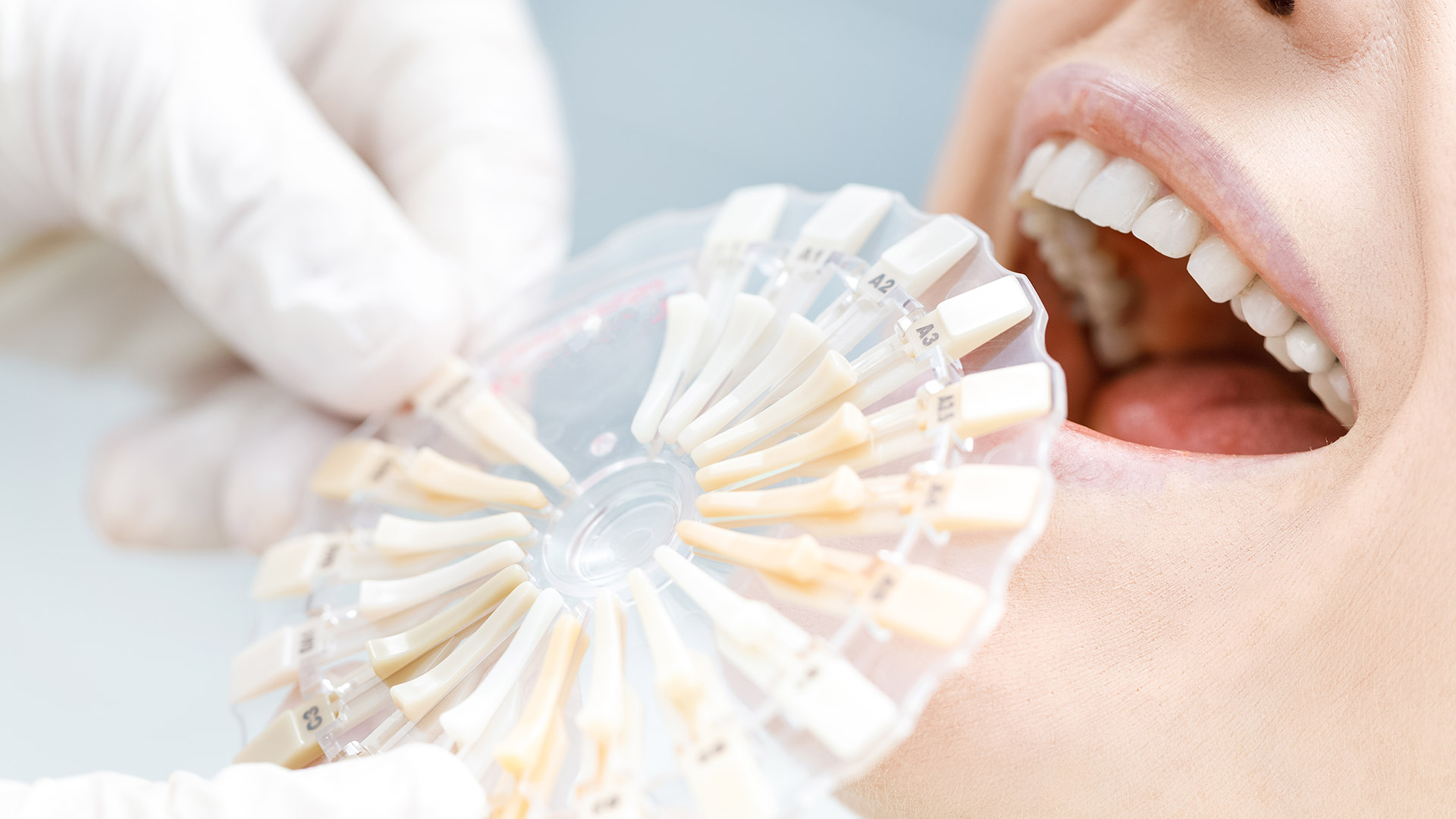 Jak wybielić zęby? Skuteczne, szybkie i nieniszczące szkliwa metody